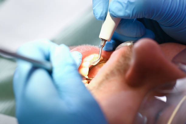 Best Urgent Care for Lost Fillings or Crowns in Rural Hill, TN