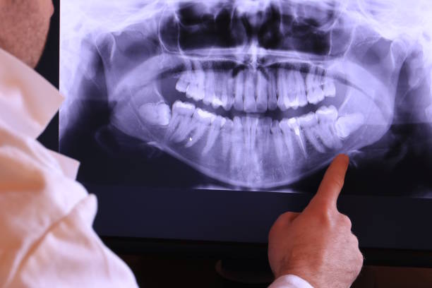 Best Emergency Tooth Extraction in Rural Hill, TN